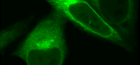 Image visualising mTOR protein in cancer (HeLa) cells