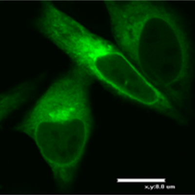 Image visualising mTOR protein in cancer (HeLa) cells