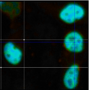Spectroscopy image showing cell nuclei before laser induced damage. The spots are very bright