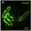 SIM images of E.coli and the vesicle formed to house the protein outside of the cell. 
