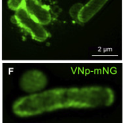 SIM images of E.coli and the vesicle formed to house the protein outside of the cell. 
