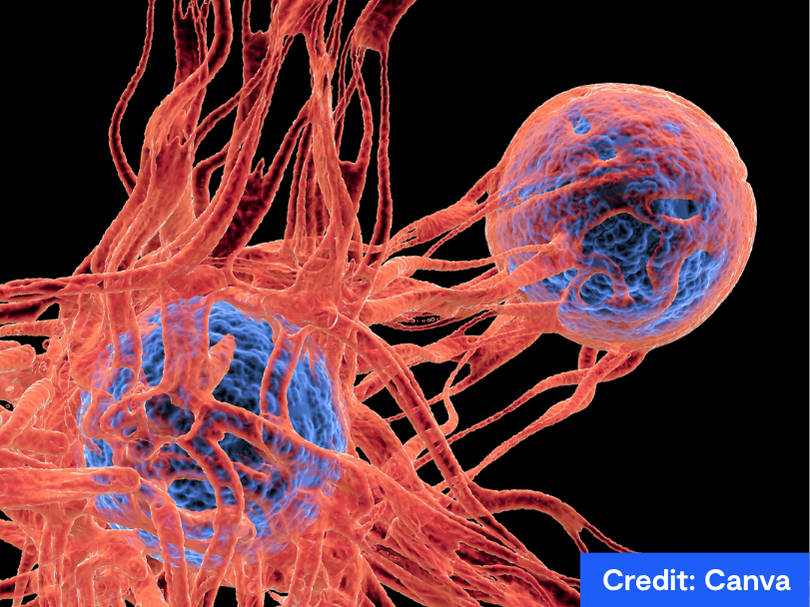 Cancer cells, showing the blood vessel formation providing the the cells with oxygens and nutrigens. 