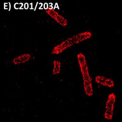 Super resolution imaging of E. Coli cells