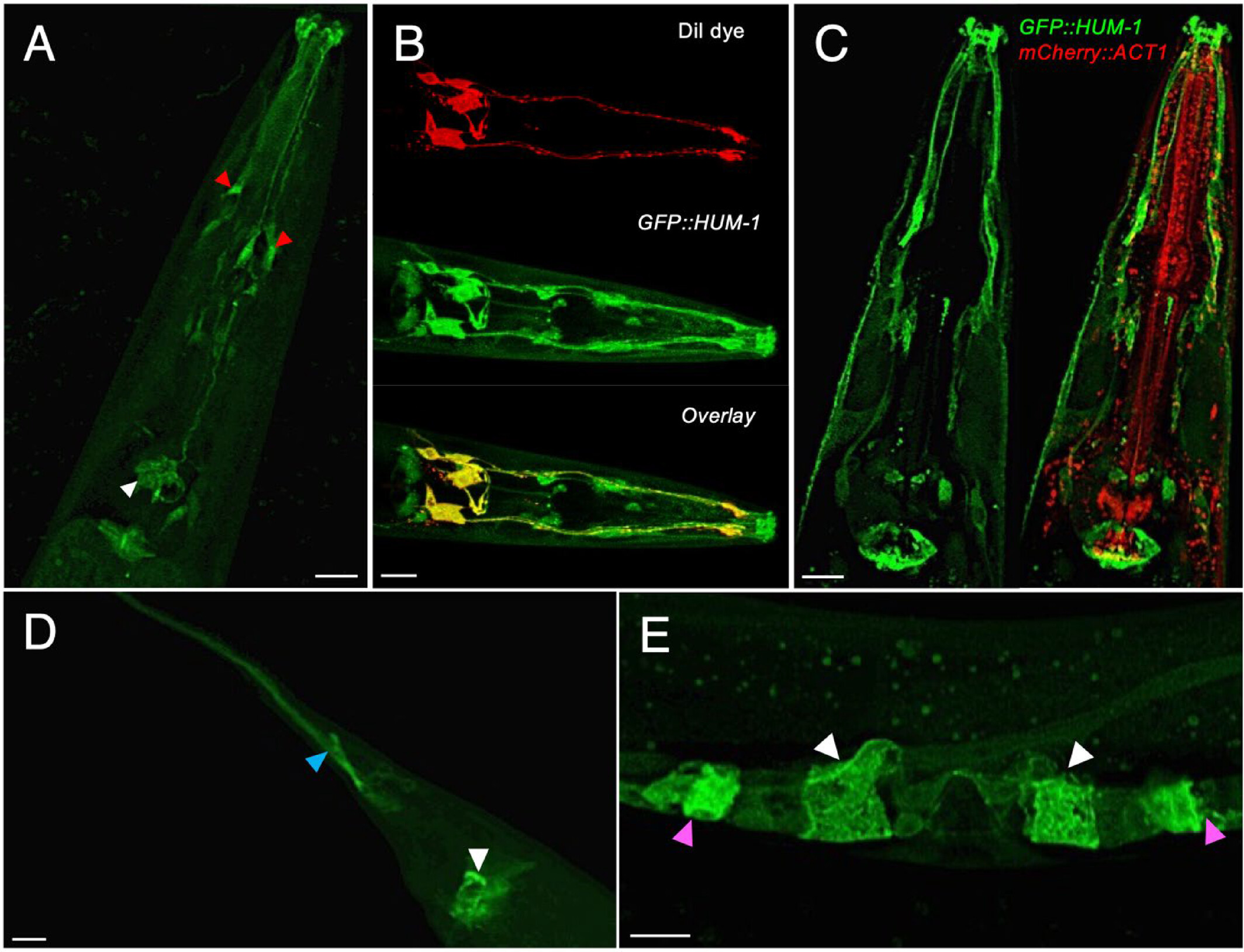 myosin, HUM-1.jpg