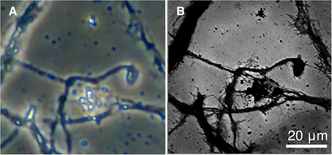 Mouse neuron image no text.jpg