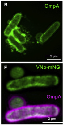 SIM images of E.coli showing the vesicle formed on the outside of the cell membrane.