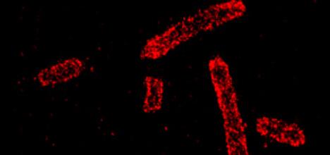 Super resolution imaging of E. Coli cells