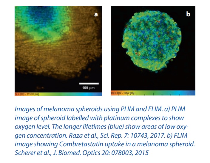 melanoma spheroids.jpg