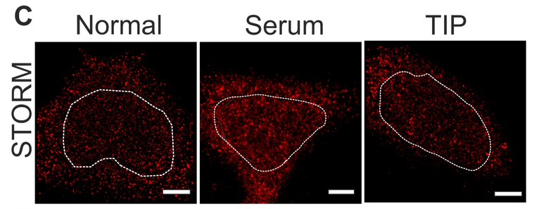 STORM imaging myosin VI.png